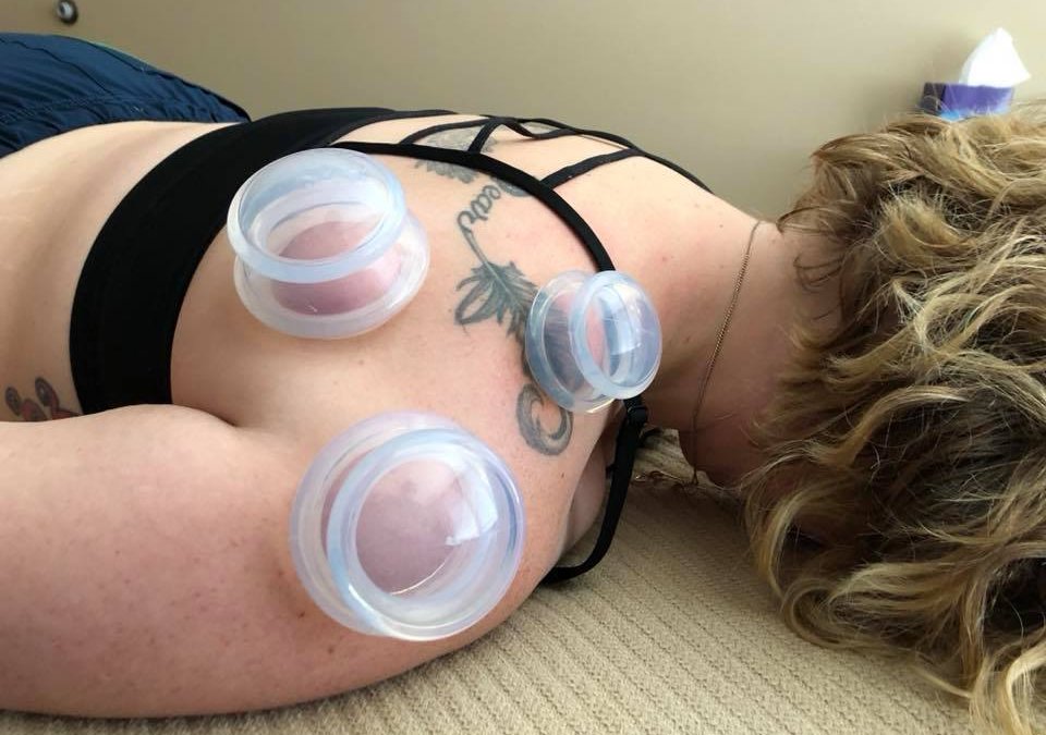 Let’s talk about Lacey Massage Cupping!